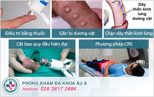 bệnh viện khám nam khoa ở TPHCM